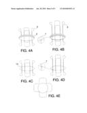 PROSTHESIS FOR ANASTOMOSIS diagram and image