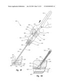 TISSUE PUNCTURE CLOSURE METHOD WITH DISENGAGABLE AUTOMATIC TAMPING SYSTEM diagram and image