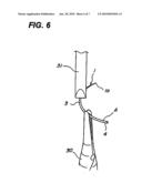 Suturing Needle diagram and image