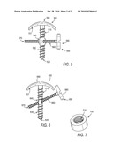 CORTICAL TENTING SCREW diagram and image