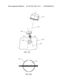 TISSUE ACCESS DEVICE WITH ALIGNMENT GUIDE AND METHODS OF USE diagram and image