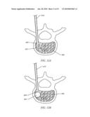 TISSUE ACCESS DEVICE WITH ALIGNMENT GUIDE AND METHODS OF USE diagram and image