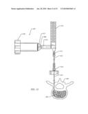 TISSUE ACCESS DEVICE WITH ALIGNMENT GUIDE AND METHODS OF USE diagram and image