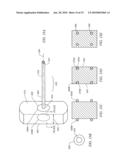 TISSUE ACCESS DEVICE WITH ALIGNMENT GUIDE AND METHODS OF USE diagram and image