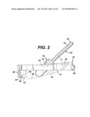 Method for Removal of Bone diagram and image