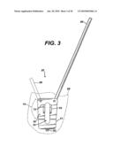 Method for Removal of Bone diagram and image