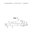 Method for Removal of Bone diagram and image