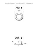 Method for Removal of Bone diagram and image