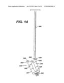 Method for Removal of Bone diagram and image