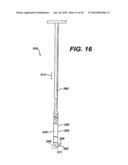 Method for Removal of Bone diagram and image