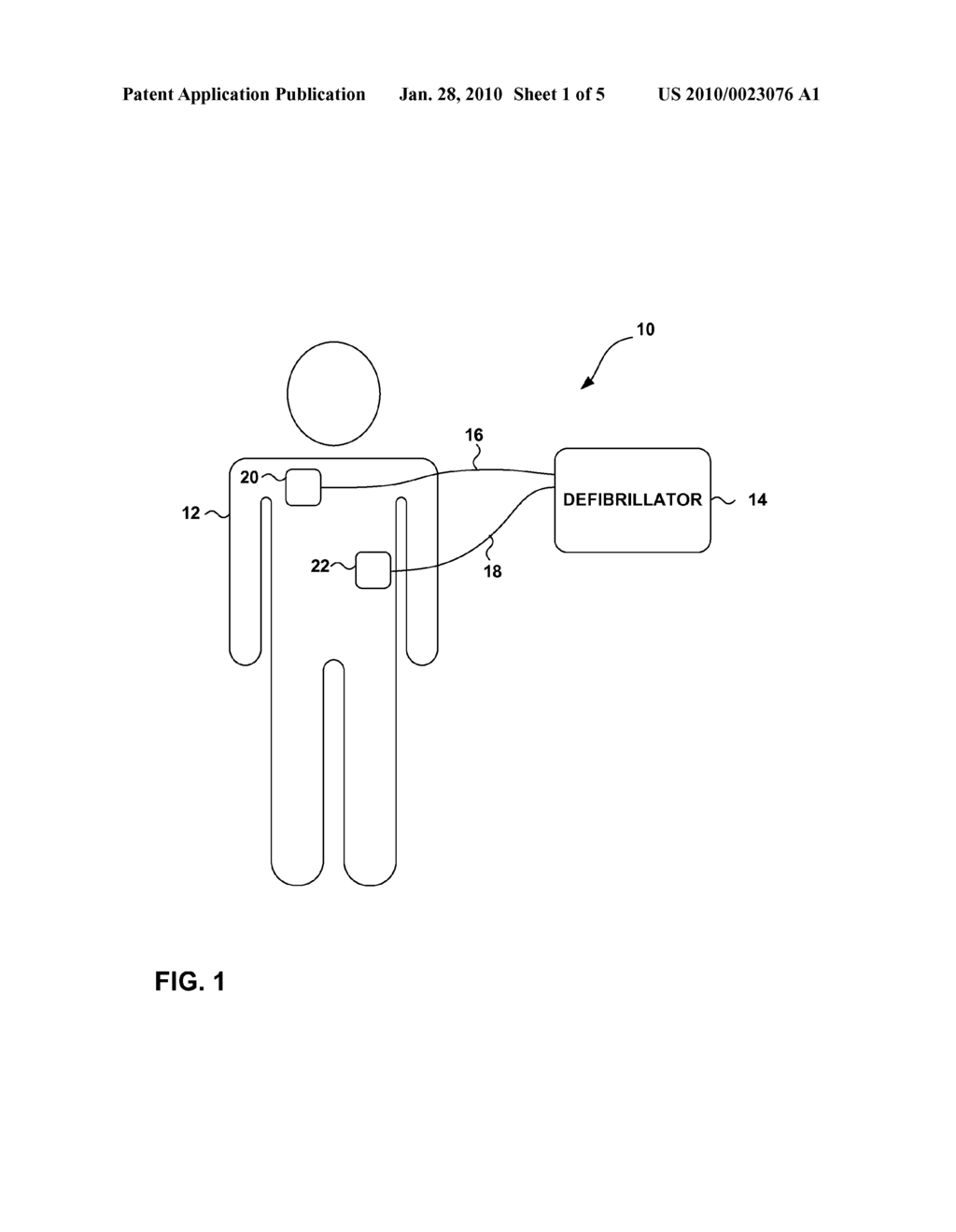 POST-DOWNLOAD PATIENT DATA PROTECTION IN A MEDICAL DEVICE - diagram, schematic, and image 02