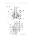 IMPLANTABLE PULSE GENERATOR EMI FILTERED FEEDTHRU USING DISCRETE CAPACITORS diagram and image