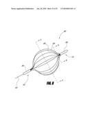 VASCULAR REMODELING DEVICE diagram and image