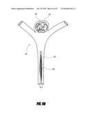 VASCULAR REMODELING DEVICE diagram and image