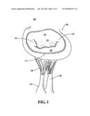 PAPILLARY MUSCLE POSITION CONTROL DEVICES, SYSTEMS, & METHODS diagram and image