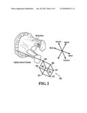 PAPILLARY MUSCLE POSITION CONTROL DEVICES, SYSTEMS, & METHODS diagram and image