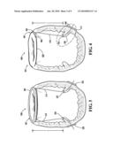 PAPILLARY MUSCLE POSITION CONTROL DEVICES, SYSTEMS, & METHODS diagram and image