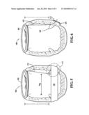 PAPILLARY MUSCLE POSITION CONTROL DEVICES, SYSTEMS, & METHODS diagram and image