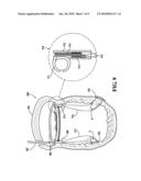 PAPILLARY MUSCLE POSITION CONTROL DEVICES, SYSTEMS, & METHODS diagram and image