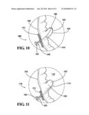 PAPILLARY MUSCLE POSITION CONTROL DEVICES, SYSTEMS, & METHODS diagram and image