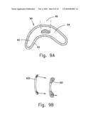 INTRAORAL CPAP INTERFACE diagram and image