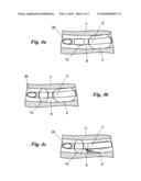 ENDOTRACHEAL DEVICE FOR MECHANICAL VENTILATION diagram and image