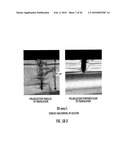 TRANSPARENT MATERIAL PROCESSING WITH AN ULTRASHORT PULSE LASER diagram and image