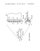 Rib Post diagram and image