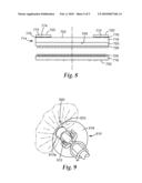 SURFACE MODIFYING APPARATUS HAVING ILLUMINATION SYSTEM AND METHOD THEREOF diagram and image