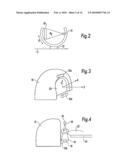 Image-guided multi-source radiotherapy diagram and image