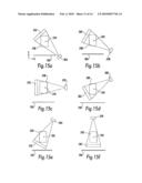 Image-guided multi-source radiotherapy diagram and image