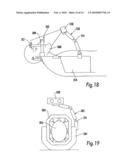 Image-guided multi-source radiotherapy diagram and image