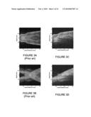 IN VIVO STRUCTURAL AND FLOW IMAGING diagram and image