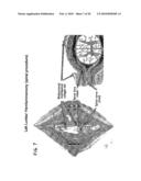 METHOD FOR DIRECTED CELL IN-GROWTH AND CONTROLLED TISSUE REGENERATION IN SPINAL SURGERY diagram and image