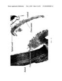 METHOD FOR DIRECTED CELL IN-GROWTH AND CONTROLLED TISSUE REGENERATION IN SPINAL SURGERY diagram and image