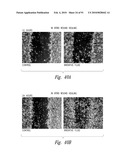 METHODS OF THERAPEUTIC TREATMENT OF EYES diagram and image