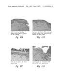 METHODS OF THERAPEUTIC TREATMENT OF EYES diagram and image