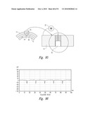 METHODS OF THERAPEUTIC TREATMENT OF EYES diagram and image