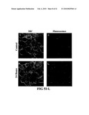 COMPOSITIONS AND METHODS FOR DIAGNOSING, TREATING, AND PREVENTING PROSTATE CONDITIONS diagram and image