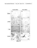 COMPOSITIONS AND METHODS FOR DIAGNOSING, TREATING, AND PREVENTING PROSTATE CONDITIONS diagram and image