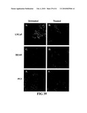 COMPOSITIONS AND METHODS FOR DIAGNOSING, TREATING, AND PREVENTING PROSTATE CONDITIONS diagram and image