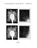 Systematic identification of new anti-prion drugs by high-throughput screening based on scanning for intensely fluorescent targets (sift) diagram and image