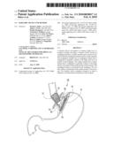 BARIATRIC DEVICE AND METHOD diagram and image