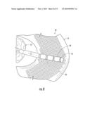 BARIATRIC DEVICE AND METHOD diagram and image