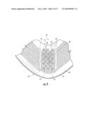 BARIATRIC DEVICE AND METHOD diagram and image