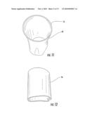 BARIATRIC DEVICE AND METHOD diagram and image