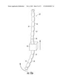 BARIATRIC DEVICE AND METHOD diagram and image