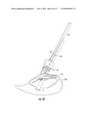 BARIATRIC DEVICE AND METHOD diagram and image