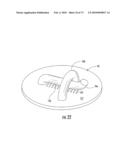 BARIATRIC DEVICE AND METHOD diagram and image