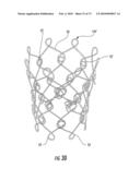 BARIATRIC DEVICE AND METHOD diagram and image